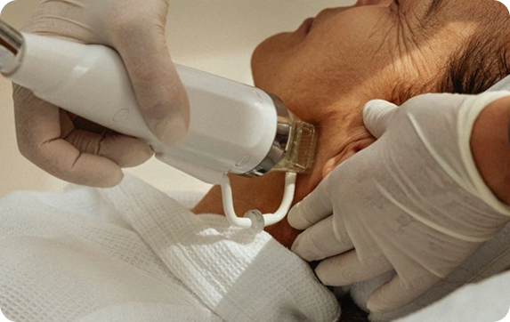 Clinical laser treatment being performed